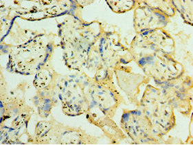Immunohistochemistry of paraffin-embedded human placenta tissue using CSB-PA017234ESR2HU at dilution of 1:100