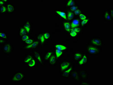 Immunofluorescence staining of Hela cells with CSB-PA017254LA01HU at 1:133, counter-stained with DAPI. The cells were fixed in 4% formaldehyde, permeabilized using 0.2% Triton X-100 and blocked in 10% normal Goat Serum. The cells were then incubat...
