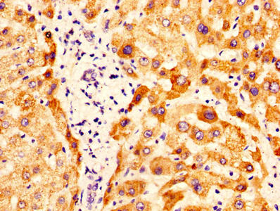 IHC image of CSB-PA017270LA01HU diluted at 1:400 and staining in paraffin-embedded human liver tissue performed on a Leica BondTM system. After dewaxing and hydration, antigen retrieval was mediated by high pressure in a citrate buffer (pH 6.0). S...