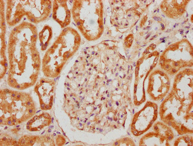 IHC image of CSB-PA017273LA01HU diluted at 1:300 and staining in paraffin-embedded human kidney tissue performed on a Leica BondTM system. After dewaxing and hydration, antigen retrieval was mediated by high pressure in a citrate buffer (pH 6.0)....