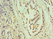 Immunohistochemistry of paraffin-embedded human prostate tissue using CSB-PA017299ESR1HU at dilution of 1:100