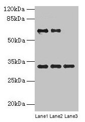 Western blot All lanes: OTX2 antibody at 4µg/ml Lane 1: Jurkat whole cell lysate Lane 2: Hela whole cell lysate Lane 3: Mouse lung tissue Secondary Goat polyclonal to rabbit IgG at 1/10000 dilution Predicted band size: 32, 33 kDa Observed band siz...