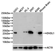 Western Blot Positive WB detected in: U251 whole cell lysate(20µg), MCF7 whole cell lysate(20µg), PC-3 whole cell lysate(20µg), 293T whole cell lysate(20µg), A549 whole cell lysate(20µg),Mouse Brain tissue lysate(20µg) All lanes: OVOL1 antibody at...