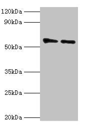 Western blot All lanes: OXCT1 antibody at 8ug/ml Lane 1: Mouse heart tissue Lane 2: Mouse kidney tissue Secondary Goat polyclonal to rabbit IgG at 1/10000 dilution Predicted band size: 57, 14 kDa Observed band size: 57 kDa