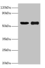 Western blot All lanes: OXCT1 antibody at 8ug/ml Lane 1: Mouse heart tissue Lane 2: Mouse kidney tissue Secondary Goat polyclonal to rabbit IgG at 1/10000 dilution Predicted band size: 57, 14 kDa Observed band size: 57 kDa