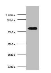 Western blot All lanes: OXCT1 antibody at 2µg/ml + Hela whole cell lysate Secondary Goat polyclonal to rabbit IgG at 1/15000 dilution Predicted band size: 57, 14 kDa Observed band size: 57 kDa