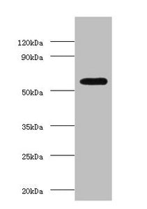 Western blot All lanes: OXCT1 antibody at 2µg/ml + Hela whole cell lysate Secondary Goat polyclonal to rabbit IgG at 1/15000 dilution Predicted band size: 57, 14 kDa Observed band size: 57 kDa
