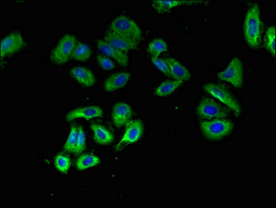 Immunofluorescent analysis of HepG2 cells using CSB-PA017316LA01HU at dilution of 1:100 and Alexa Fluor 488-congugated AffiniPure Goat Anti-Rabbit IgG(H+L)