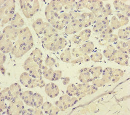 Immunohistochemistry of paraffin-embedded human pancreatic tissue using CSB-PA017321ESR2HU at dilution of 1:100