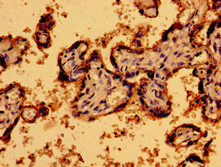 Immunohistochemistry of paraffin-embedded human placenta tissue using CSB-PA017326LA01HU at dilution of 1:100