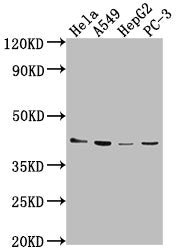 Western Blot Positive WB detected in: Hela whole cell lysate, A549 whole cell lysate, HepG2 whole cell lysate, PC-3 whole cell lysate All lanes: LPAR6 antibody at 1:2000 Secondary Goat polyclonal to rabbit IgG at 1/50000 dilution Predicted band si...