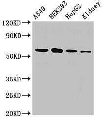 Western Blot Positive WB detected in: A549 whole cell lysate, HEK293 whole cell lysate, HepG2 whole cell lysate, Rat kidney tissue All lanes: P4HA1 antibody at 2.5ug/ml Secondary Goat polyclonal to rabbit IgG at 1/50000 dilution Predicted band siz...