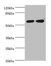 Western blot All lanes: P4HA2 antibody at 6ug/ml Lane 1: HepG2 whole cell lysate Lane 2: 293T whole cell lysate Secondary Goat polyclonal to rabbit IgG at 1/10000 dilution Predicted band size: 61 kDa Observed band size: 61 kDa