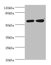 Western blot All lanes: P4HA2 antibody at 6ug/ml Lane 1: HepG2 whole cell lysate Lane 2: 293T whole cell lysate Secondary Goat polyclonal to rabbit IgG at 1/10000 dilution Predicted band size: 61 kDa Observed band size: 61 kDa