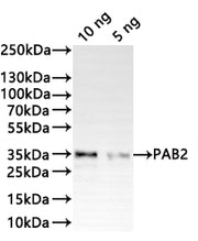 Western Blot Positive WB detected in: recombinant protein All lanes:PAB2 Antibody at 1:1000 Secondary Goat polyclonal to rabbit IgG at 1/20000 dilution Predicted band size: 35.5 kDa Observed band size: 35 kDa