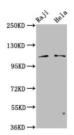 Western Blot Positive WB detected in: Raji whole cell lysate, Hela whole cell lysate All lanes: PACS1 antibody at 3.2µg/ml Secondary Goat polyclonal to rabbit IgG at 1/50000 dilution Predicted band size: 105, 110 kDa Observed band size: 110 kDa