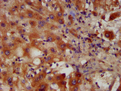 IHC image of CSB-PA017372LA01HU diluted at 1:400 and staining in paraffin-embedded human liver tissue performed on a Leica BondTM system. After dewaxing and hydration, antigen retrieval was mediated by high pressure in a citrate buffer (pH 6.0). S...