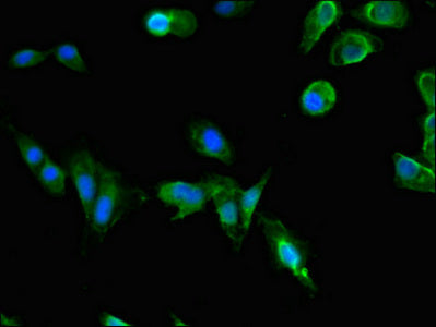 Immunofluorescent analysis of Hela cells using CSB-PA017383LA01HU at dilution of 1:100 and Alexa Fluor 488-congugated AffiniPure Goat Anti-Rabbit IgG(H+L)