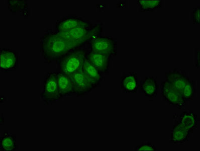 Immunofluorescent analysis of MCF-7 cells using CSB-PA017384LA01HU at dilution of 1:100 and Alexa Fluor 488-congugated AffiniPure Goat Anti-Rabbit IgG(H+L)