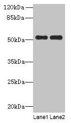 Western blot All lanes: PAH antibody at 2.5µg/ml Lane 1: Mouse kidney tissue Lane 2: Mouse liver tissue Secondary Goat polyclonal to rabbit IgG at 1/10000 dilution Predicted band size: 52 kDa Observed band size: 52 kDa
