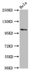 Western Blot Positive WB detected in: Hela whole cell lysate All lanes: PAM antibody at 5.6µg/ml Secondary Goat polyclonal to rabbit IgG at 1/50000 dilution Predicted band size: 109, 97, 101, 99, 107 kDa Observed band size: 109 kDa