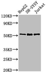 Western Blot Positive WB detected in: HepG2 whole cell lysate, SH-SY5Y whole cell lysate, Jurkat whole cell lysate All lanes: PRKN antibody at 3µg/ml Secondary Goat polyclonal to rabbit IgG at 1/50000 dilution Predicted band size: 52, 49, 24, 31,...