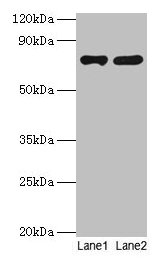 Western blot All lanes: PARN antibody at 2µg/ml Lane 1: Jurkat whole cell lysate Lane 2: A431 whole cell lysate Secondary Goat polyclonal to rabbit IgG at 1/10000 dilution Predicted band size: 74, 67, 68, 53 kDa Observed band size: 74 kDa