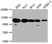 Western Blot Positive WB detected in: K562 whole cell lysate, Raji whole cell lysate, Hela whole cell lysate, A549 whole cell lysate, NTERA-2 whole cell lysate All lanes: PARP1 antibody at 1:2000 Secondary Goat polyclonal to rabbit IgG at 1/50000...