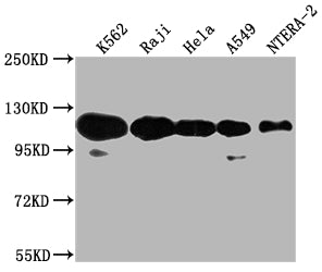 Western Blot Positive WB detected in: K562 whole cell lysate, Raji whole cell lysate, Hela whole cell lysate, A549 whole cell lysate, NTERA-2 whole cell lysate All lanes: PARP1 antibody at 1:2000 Secondary Goat polyclonal to rabbit IgG at 1/50000...