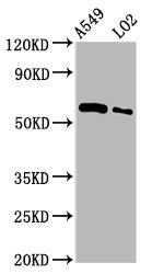Western Blot Positive WB detected in: A549 whole cell lysate, LO2 whole cell lysate All lanes: PARP3 antibody at 3.5µg/ml Secondary Goat polyclonal to rabbit IgG at 1/50000 dilution Predicted band size: 61 kDa Observed band size: 61 kDa