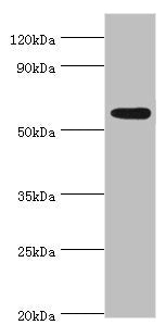 Western blot All lanes: Poly [ADP-ribose] polymerase 3 antibody at 2ug/ml + Mouse heart tissue Secondary Goat polyclonal to rabbit IgG at 1/10000 dilution Predicted band size: 60 kDa Observed band size: 60 kDa