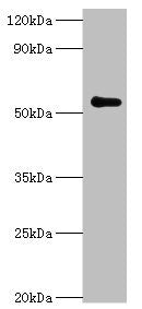 Western blot All lanes: Poly [ADP-ribose] polymerase 3 antibody at 7ug/ml + Mouse kidney tissue Secondary Goat polyclonal to rabbit IgG at 1/10000 dilution Predicted band size: 60 kDa Observed band size: 60 kDa