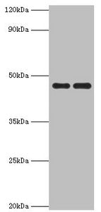 Western blot All lanes: Paired box protein Pax-6 antibody at 1ug/ml Lane 1: Mouse stomach tissue Lane 2: Mouse eye tissue Secondary Goat polyclonal to rabbit IgG at 1/10000 dilution Predicted band size: 47, 49 kDa Observed band size: 47 kDa