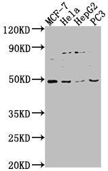Western Blot Positive WB detected in: MCF-7 whole cell lysate, Hela whole cell lysate, HepG2 whole cell lysate, PC-3 whole cell lysate All lanes: PAX8 antibody at 1:2000 Secondary Goat polyclonal to rabbit IgG at 1/50000 dilution Predicted band si...