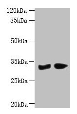 Western blot All lanes: PBLD antibody at 6µg/ml Lane 1: Mouse liver tissue Lane 2: Mouse kidney tissue Secondary Goat polyclonal to rabbit IgG at 1/10000 dilution Predicted band size: 32 kDa Observed band size: 32 kDa