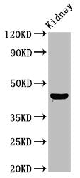 Western Blot Positive WB detected in: Rat kidney tissue All lanes: PBX1 antibody at 4.7ug/ml Secondary Goat polyclonal to rabbit IgG at 1/50000 dilution Predicted band size: 47, 39 kDa Observed band size: 47 kDa