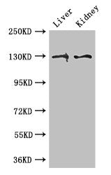 Western Blot Positive WB detected in: Mouse liver tissue, Mouse kidney tissue All lanes: PC antibody at 3ug/ml Secondary Goat polyclonal to rabbit IgG at 1/50000 dilution Predicted band size: 130, 58 kDa Observed band size: 130 kDa