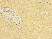 Immunohistochemistry of paraffin-embedded human liver tissue using CSB-PA017514LA01HU at dilution of 1:100