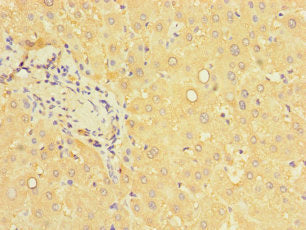 Immunohistochemistry of paraffin-embedded human liver tissue using CSB-PA017514LA01HU at dilution of 1:100