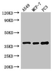 Western Blot Positive WB detected in: A549 whole cell lysate, MCF-7 whole cell lysate, PC-3 whole cell lysate All lanes: SLC9A3R2 antibody at 3ug/ml Secondary Goat polyclonal to rabbit IgG at 1/50000 dilution Predicted band size: 38, 37, 25 kDa Ob...