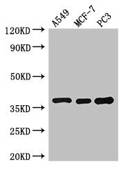 Western Blot Positive WB detected in: A549 whole cell lysate, MCF-7 whole cell lysate, PC-3 whole cell lysate All lanes: SLC9A3R2 antibody at 3ug/ml Secondary Goat polyclonal to rabbit IgG at 1/50000 dilution Predicted band size: 38, 37, 25 kDa Ob...