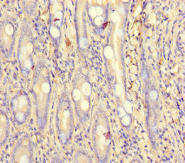 Immunohistochemistry of paraffin-embedded human small intestine tissue using CSB-PA017603LA01HU at dilution of 1:100