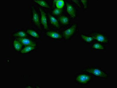 Immunofluorescent analysis of A549 cells using CSB-PA017606LA01HU at dilution of 1:100 and Alexa Fluor 488-congugated AffiniPure Goat Anti-Rabbit IgG(H+L)