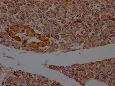 IHC image of CSB-PA017627LA11HU diluted at 1:200 and staining in paraffin-embedded human pancreatic tissue performed on a Leica BondTM system. After dewaxing and hydration, antigen retrieval was mediated by high pressure in a citrate buffer (pH 6....