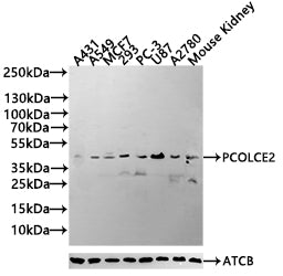Western blot All lanes: PCOLCE2 antibody at 8µg/ml Lane 1: MCF-7 whole cell lysate Lane 2: A549 whole cell lysate Lane 3: HCT116 whole cell lysate Lane 4: Human high value serum Secondary Goat polyclonal to rabbit IgG at 1/10000 dilution Predicted...