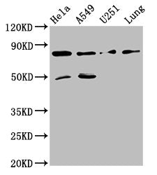 Western Blot Positive WB detected in: Hela whole cell lysate, A549 whole cell lysate, U251 whole cell lysate, Mouse lung tissue All lanes: Pcsk1 antibody at 8ug/ml Secondary Goat polyclonal to rabbit IgG at 1/50000 dilution Predicted band size: 85...