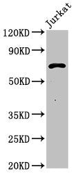 Western Blot Positive WB detected in: Jurkat whole cell lysate All lanes: Pcsk1 antibody at 3ug/ml Secondary Goat polyclonal to rabbit IgG at 1/50000 dilution Predicted band size: 71 kDa Observed band size: 71 kDa