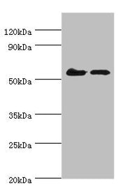 Western blot All lanes: CDK16 antibody at 5ug/ml Lane 1: Mouse brain tissue Lane 2: Mouse small intestineSecondary Goat polyclonal to rabbit IgG at 1/10000 dilution Predicted band size: 56, 64, 57 kDa Observed band size: 56 kDa