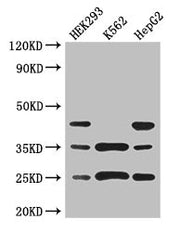 Western Blot Positive WB detected in: HEK293 whole cell lysate, K562 whole cell lysate, HepG2 whole cell lysate All lanes: PCTP antibody at 3ug/ml Secondary Goat polyclonal to rabbit IgG at 1/50000 dilution Predicted band size: 25, 17 kDa Observed...