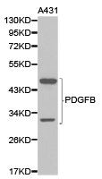 Western blot analysis of extracts of A431 cell lines using PDGFB antibody.